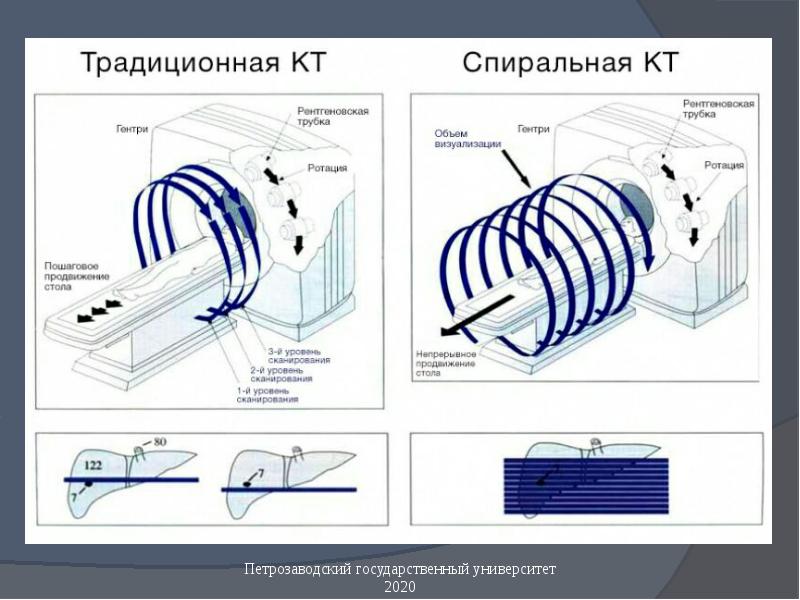 Мрт принцип работы схема