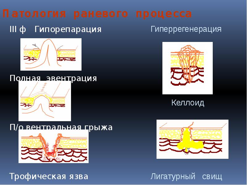 Раневой процесс