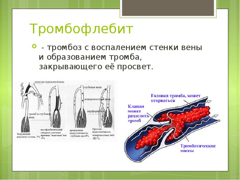 Развитие вен презентация