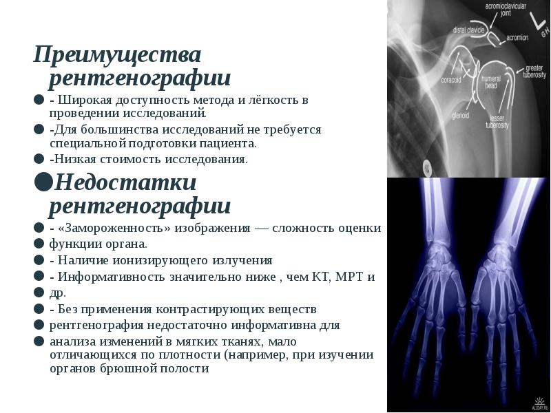 Рентгенография и рентгеноскопия