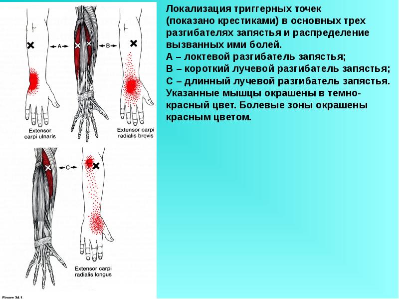 Карта триггерных точек на ногах