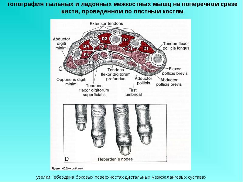 Поперечный распил кисти схема топографическая анатомия