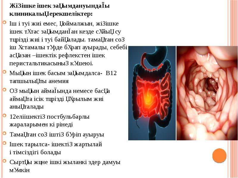 Ішек анатомиясы презентация