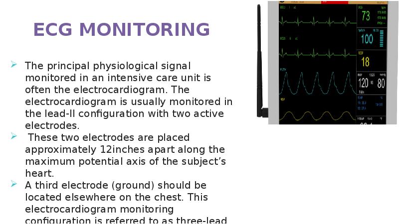 ECG MONITORING ECG MONITORING