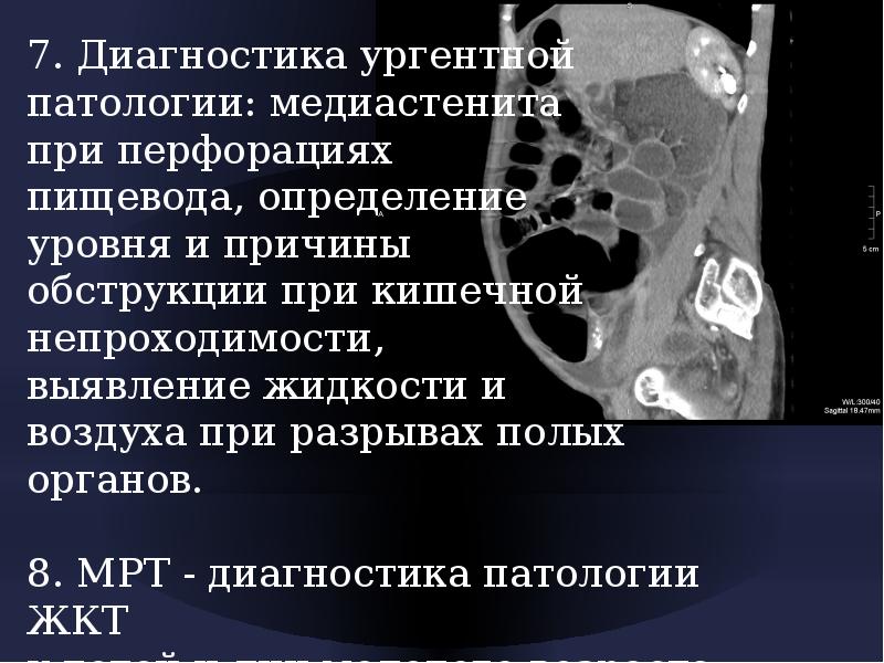 Диагностика полого органа. Методы обследования брюшной полости. Острый перитонит дифференциальная диагностика. Эндоскопия полых органов и полостей виды. Диагностика полого органа.