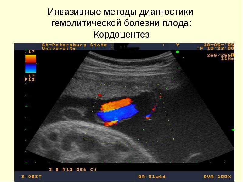 Инвазивные коридоры