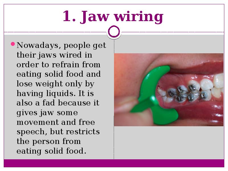 1. Jaw wiring  Nowadays, people get their jaws wired in