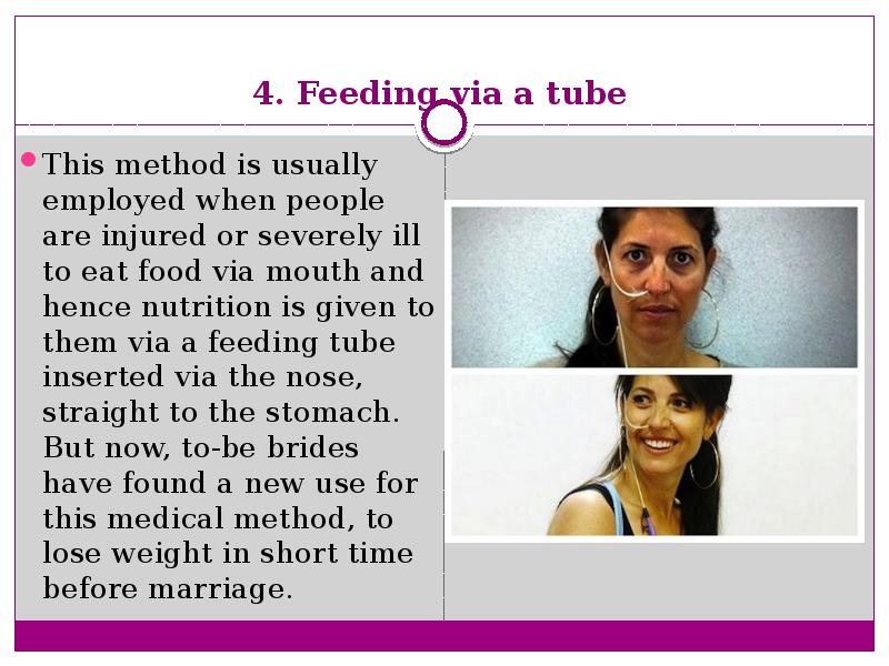 4. Feeding via a tube  This method is usually employed