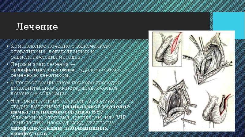 Можно Ли Заниматься Сексом После Химиотерапии Можно Ли Заниматься Сексом После Химиотерапии