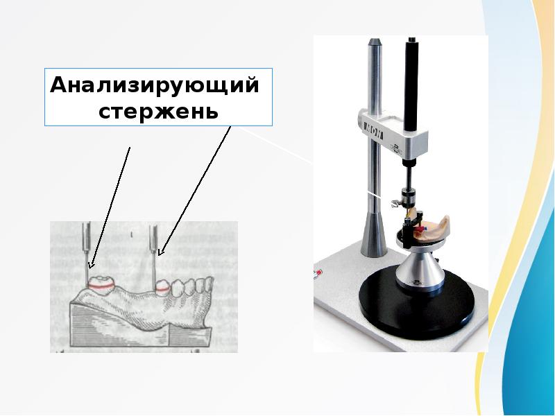 Параллелометрия в стоматологии презентация