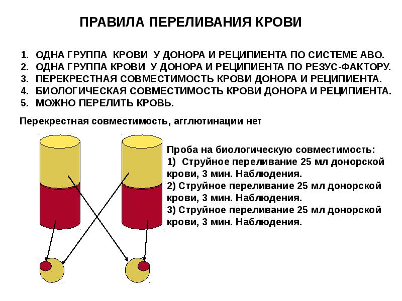 Схема переливания крови по группам крови