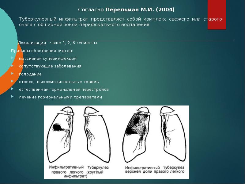 Согласно Перельман М.И. (2004)       