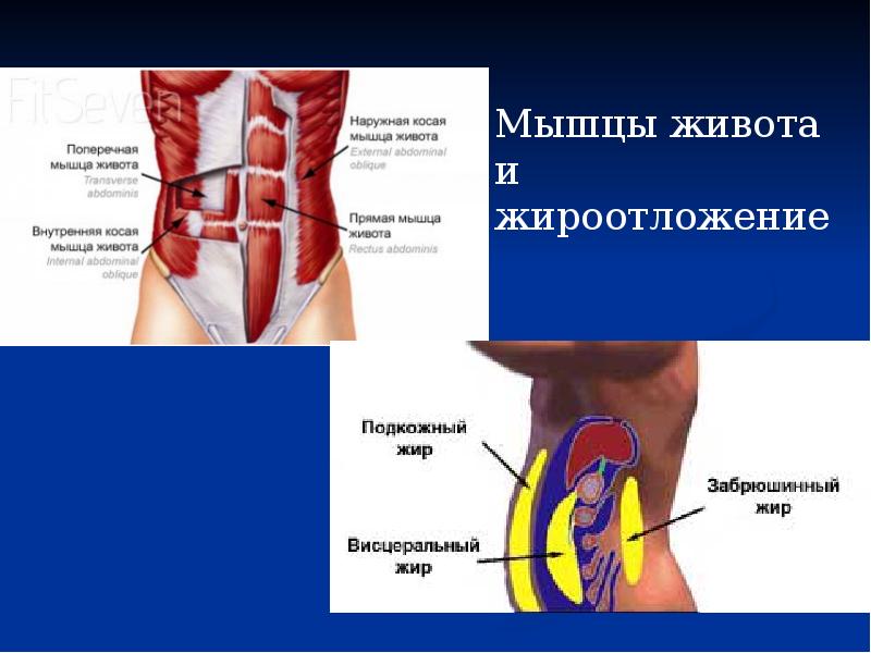 Презентация мышцы живота