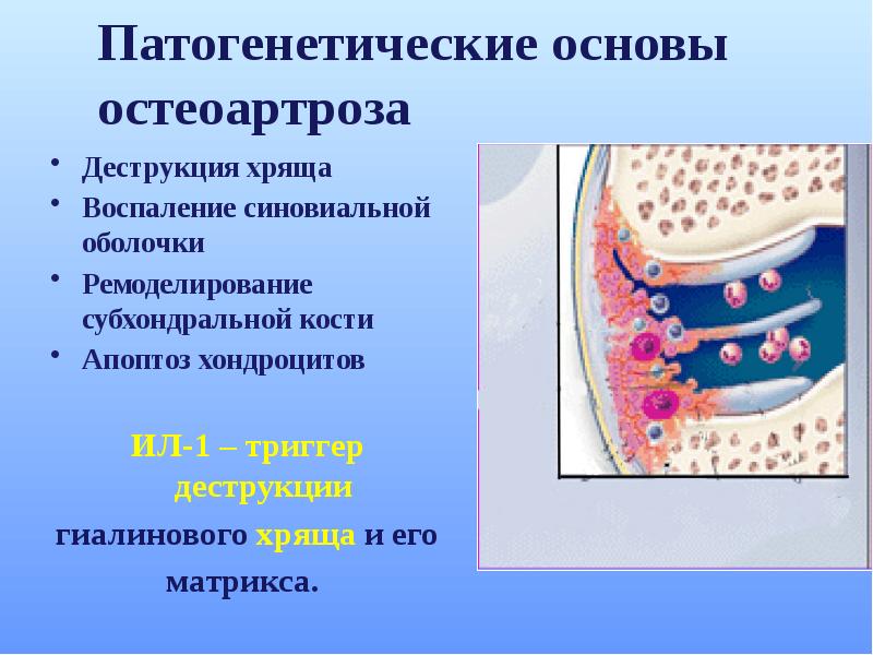 Деформациялаушы остеоартроз презентация