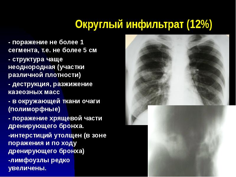 Лучевая диагностика органов дыхания презентация