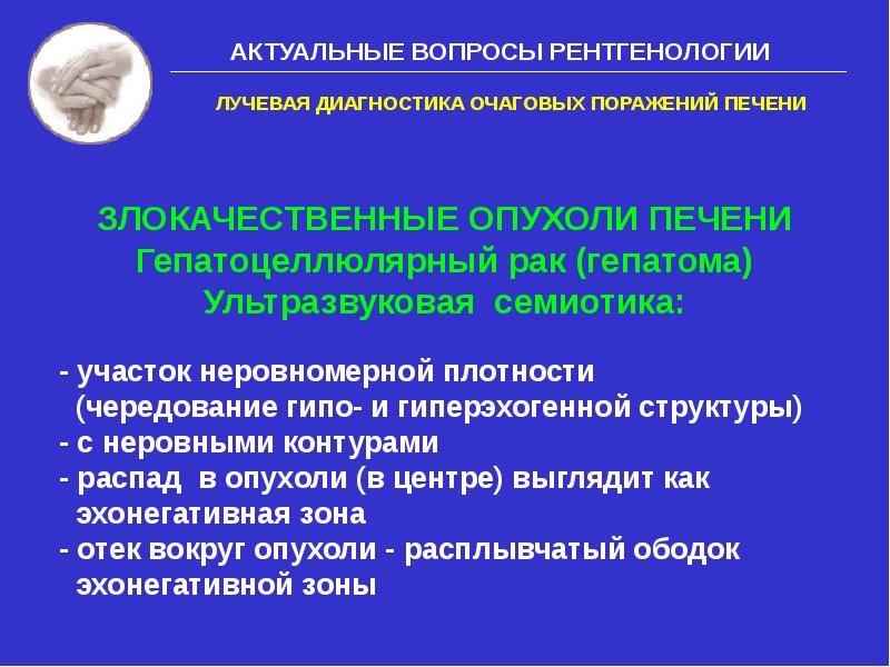 Очаговое поражение печени. Опухоли печени диагностика. Гепатоцеллюлярная карцинома дифференциальная диагностика. Метод диагностики очаговых поражений печени. Очаговые поражения печени клинические рекомендации.