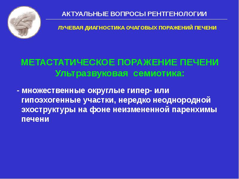 Очаговые поражения печени. Метод диагностики очаговых поражений печени. Синдром очагового поражения печени. Очаговые поражения печени Госпитальная хирургия.