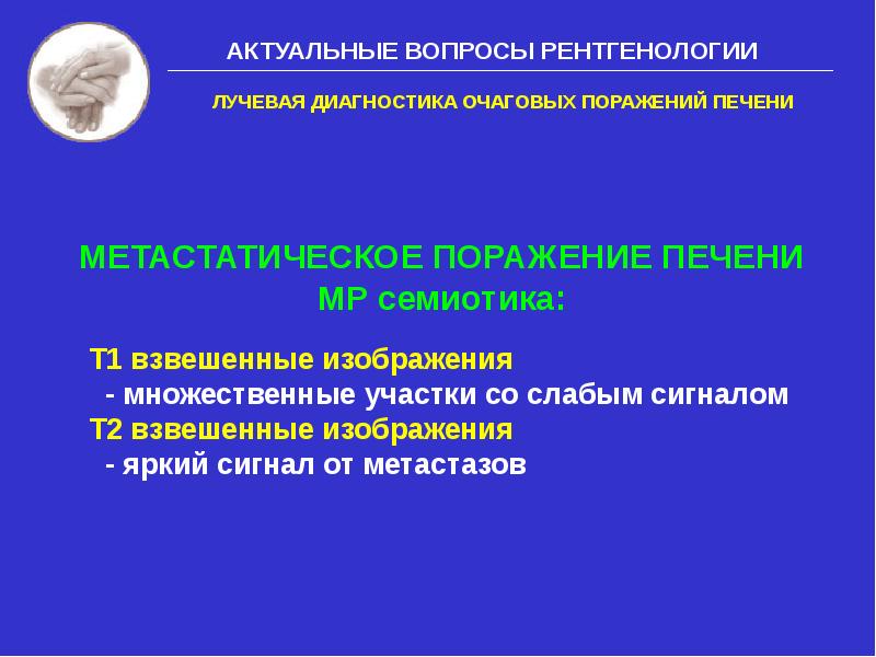 Очаговые поражения печени. Метастатическое поражение печени. Диагностика радиационных поражений. Очаговые поражения печени Госпитальная хирургия.