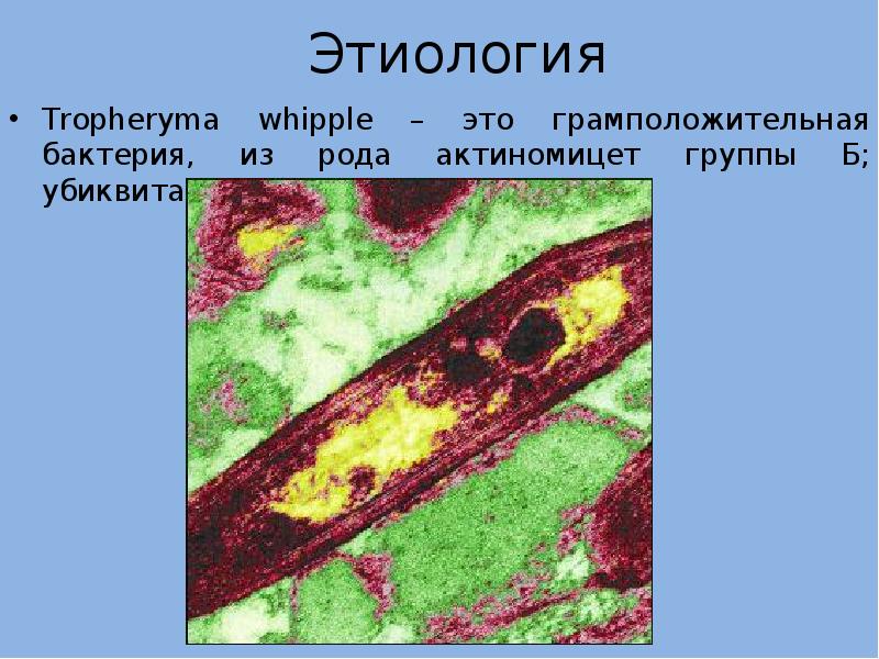 Болезнь уиппла презентация