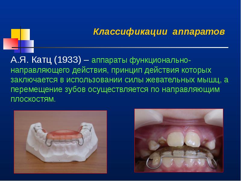 Ретенционные аппараты презентация