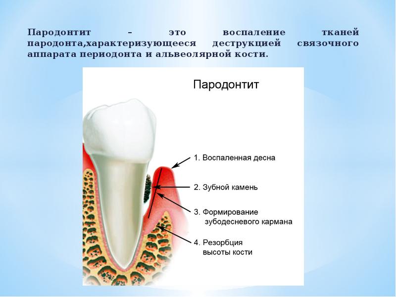 Понятие о пародонтальном комплексе особенности функционирования и биомеханики пародонта презентация