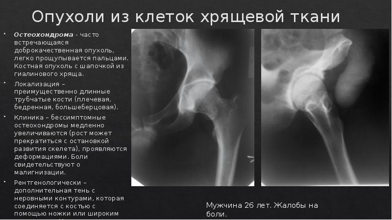 Лучевая диагностика костей презентация