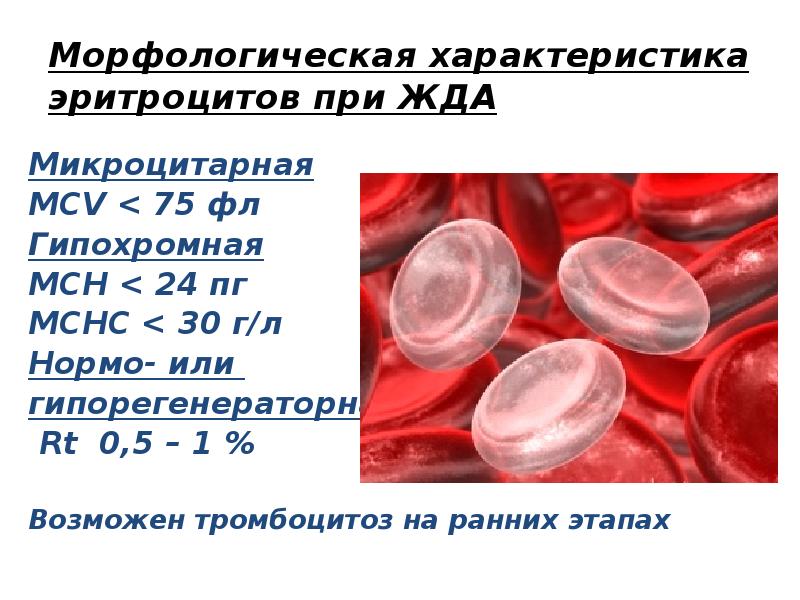 Гипохромная анемия степени. Характеристика эритроцитов при жда. Картина крови при железодефицитной анемии. Гипохромная анемия ПГ.
