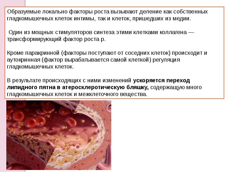 Атеросклероз симптомы. Внешние проявления атеросклероза. Внешние признаки атеросклероза. Атеросклероз симптомы у женщин.