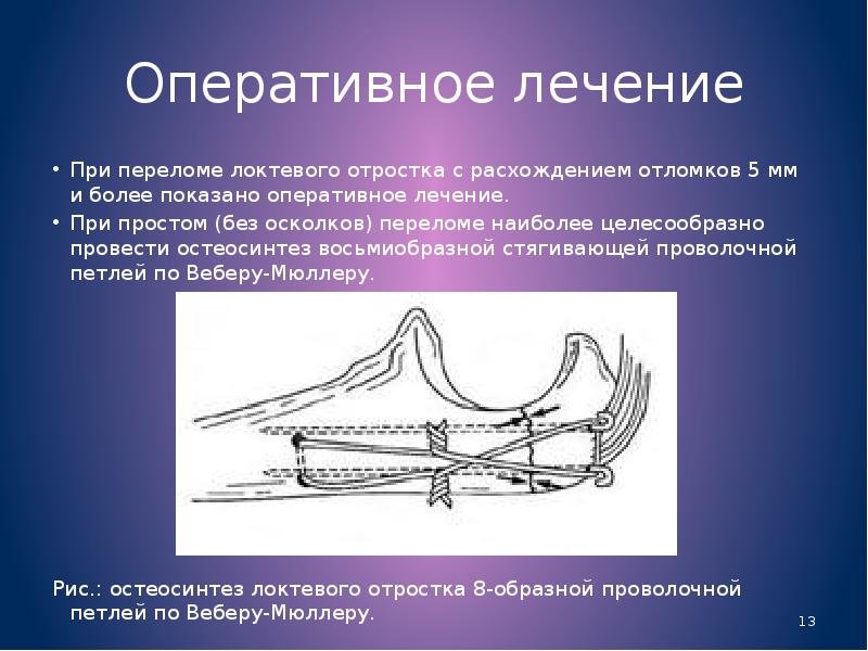 Травмы кисти презентация