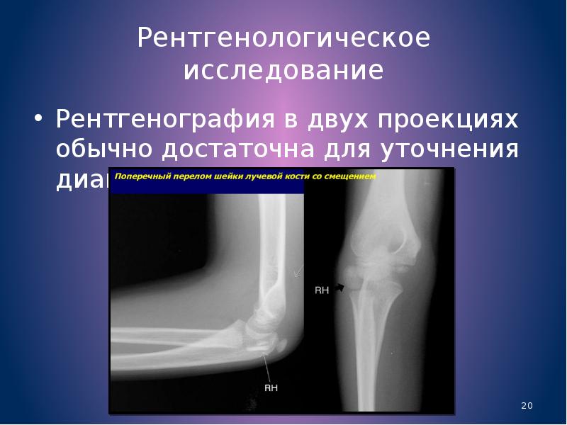 Травма кисти презентация