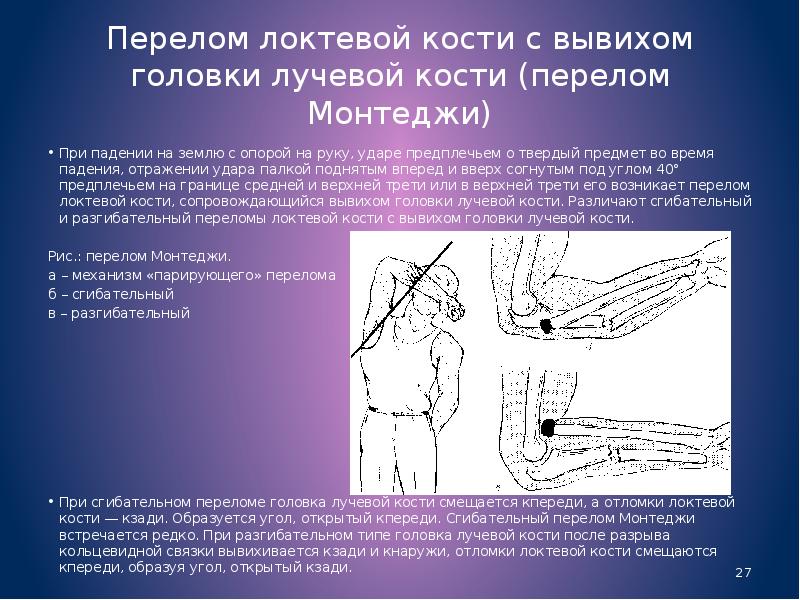 Травмы предплечья презентация