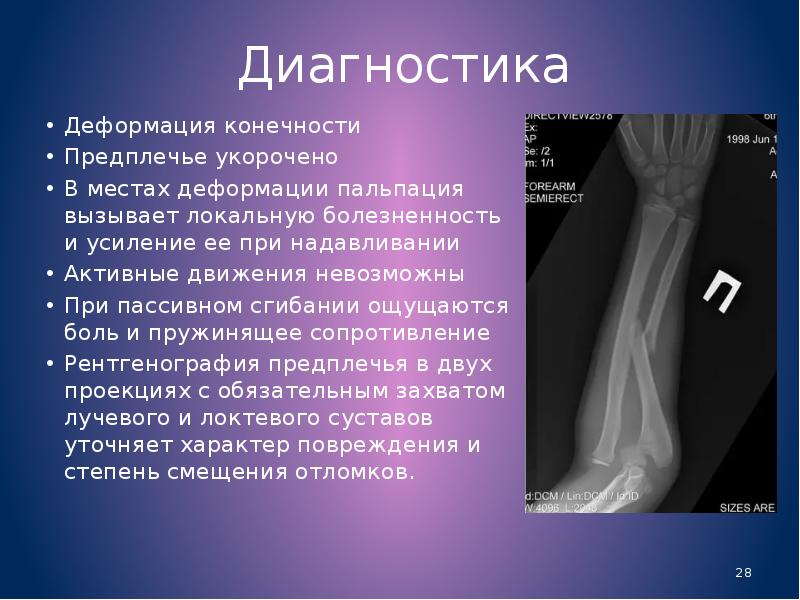 Повреждения кисти травматология презентация