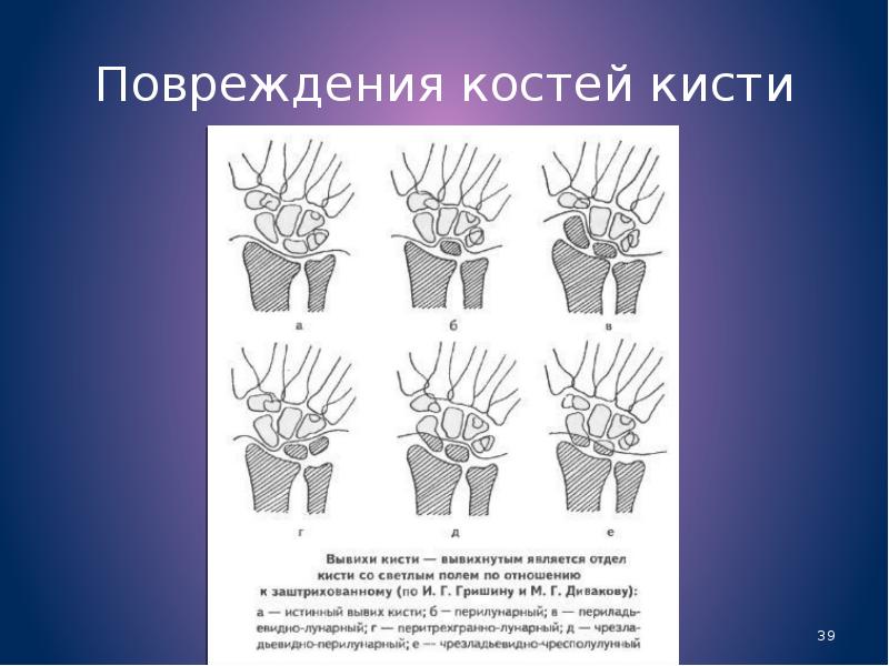 Повреждение кисти травматология презентация