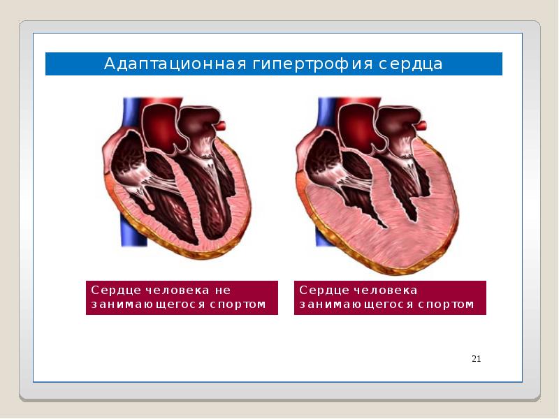 Спортивное сердце презентация