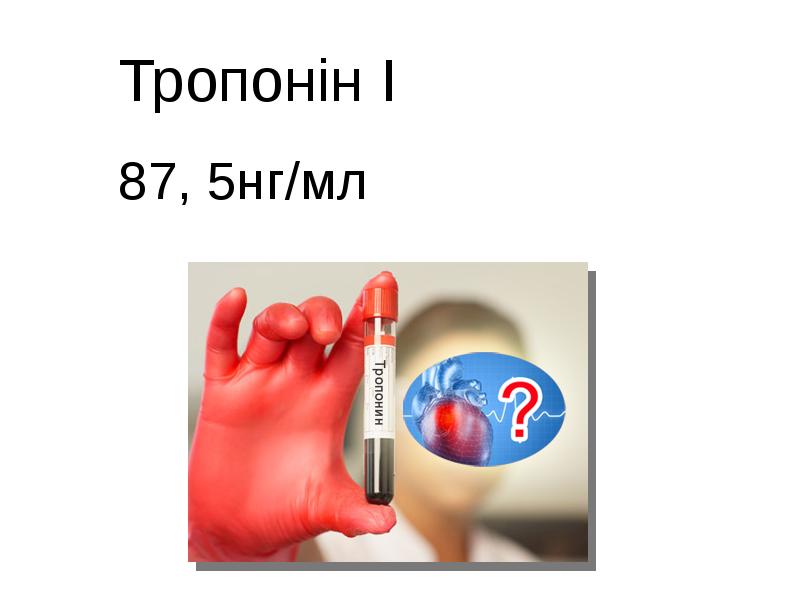 Тропонін І 87, 5нг/мл Тропонін І 87, 5нг/мл