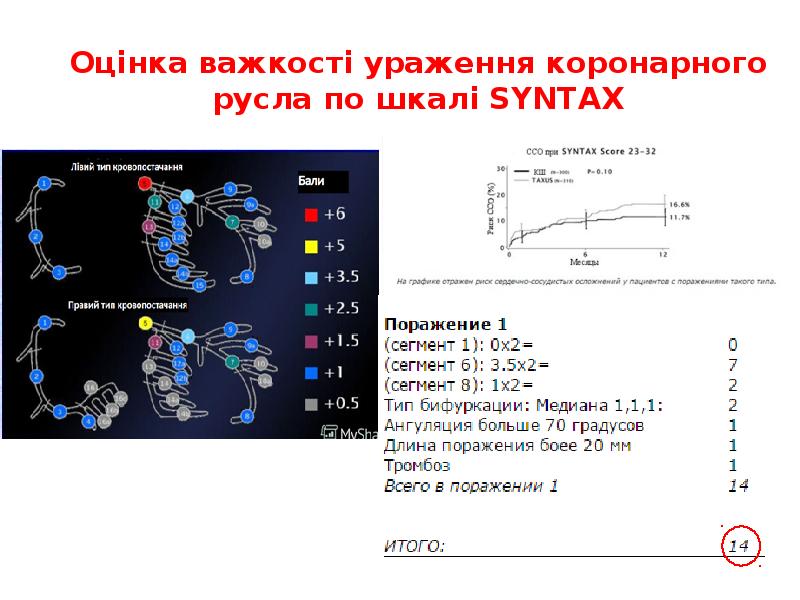 Оцінка важкості ураження коронарного русла по шкалі SYNTAX Оцінка важкості ураження коронарного русла по шкалі SYNTAX