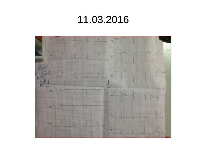 11.03.2016 11.03.2016