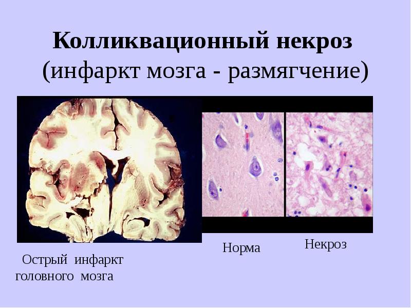 Что общего у белковых молекул и цунами? Интервью с …