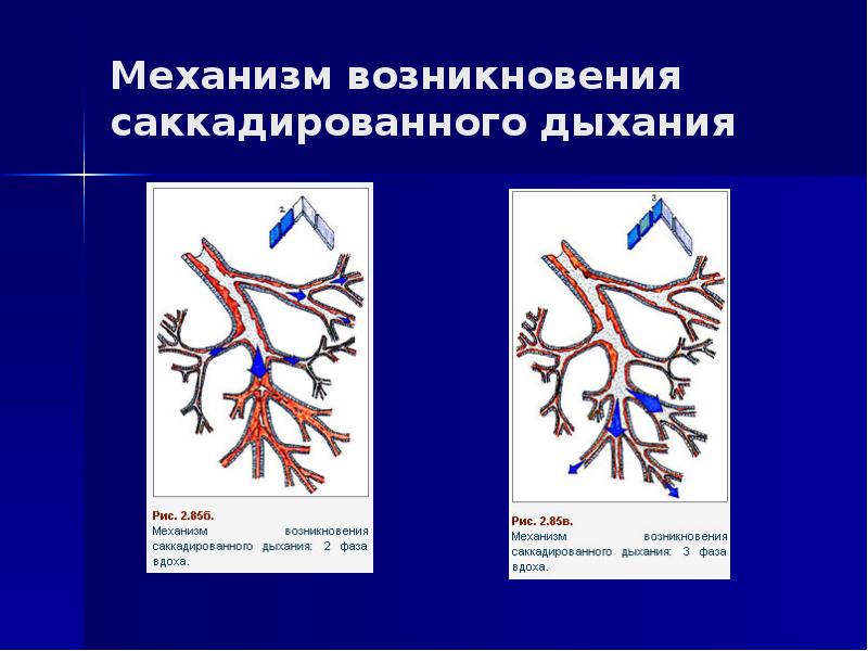 Виды дыхания при аускультации легких схема