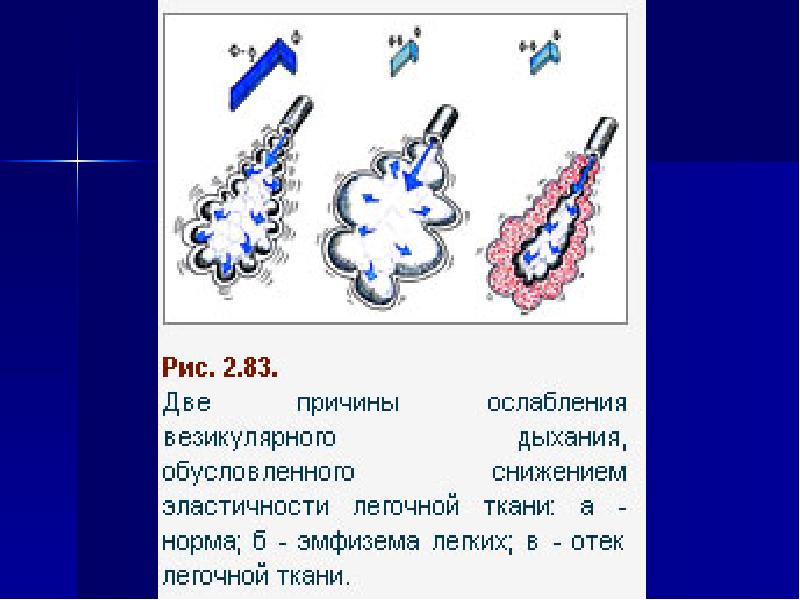 Аускультация легких презентация пропедевтика