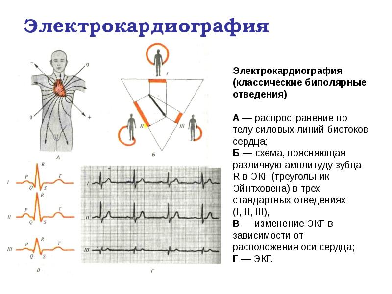 Электрокардиография Электрокардиография