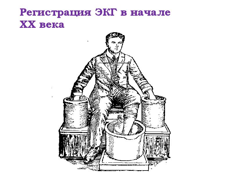 Регистрация ЭКГ в начале XX века Регистрация ЭКГ в начале XX века