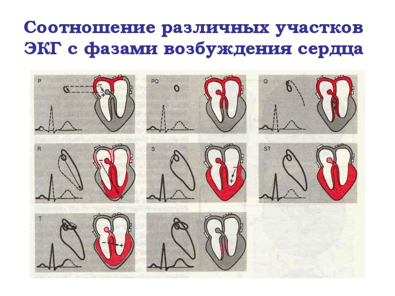 Соотношение различных участков ЭКГ с фазами возбуждения сердца Соотношение различных участков ЭКГ с фазами возбуждения сердца