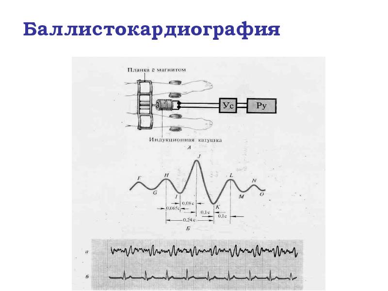Баллистокардиография Баллистокардиография