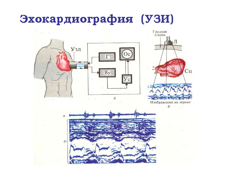 Эхокардиография (УЗИ) Эхокардиография (УЗИ)