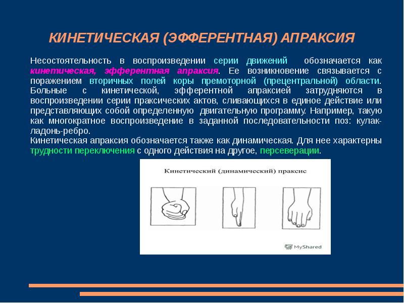 Артикуляционная апраксия презентация