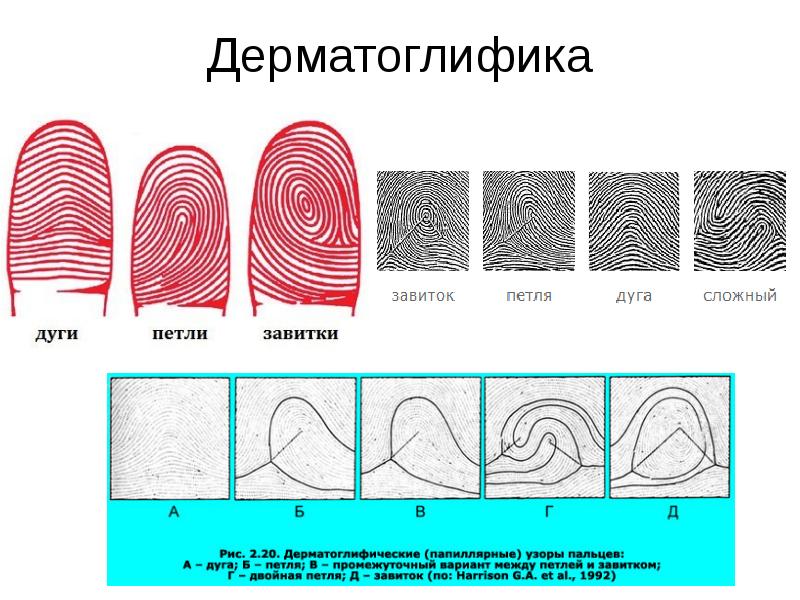 Дерматоглифический метод презентация