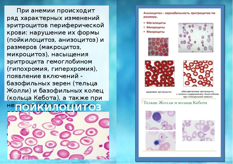 Болезни крови у детей презентация