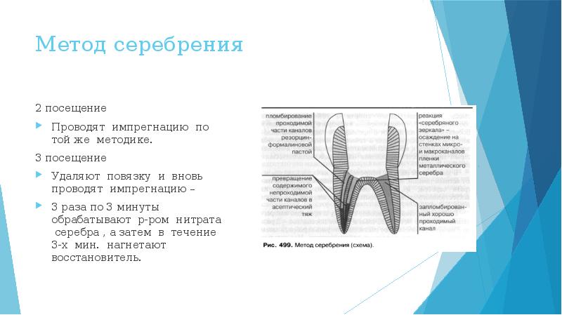 Методы лечения зубов с проблемными корневыми каналами презентация