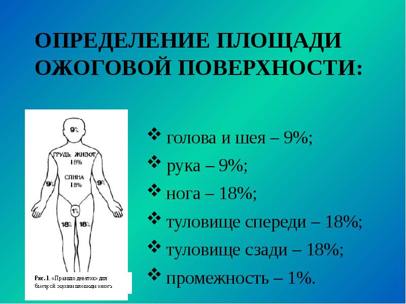 Понятие основные виды и степени ожогов презентация